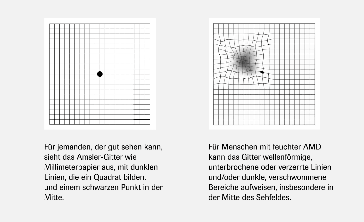 Roche_FokusMensch_AMD_Amsler_test