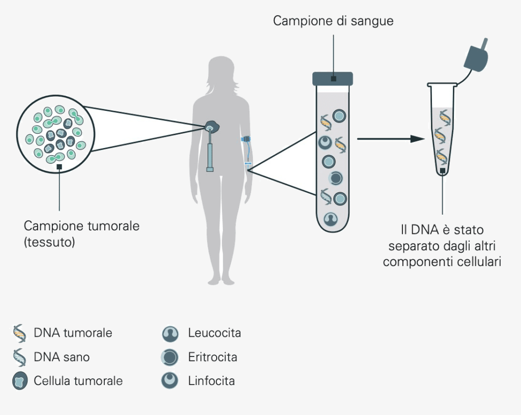 La biopsia del tumore consente di identificare alterazioni genetiche per guidare la scelta della terapia.