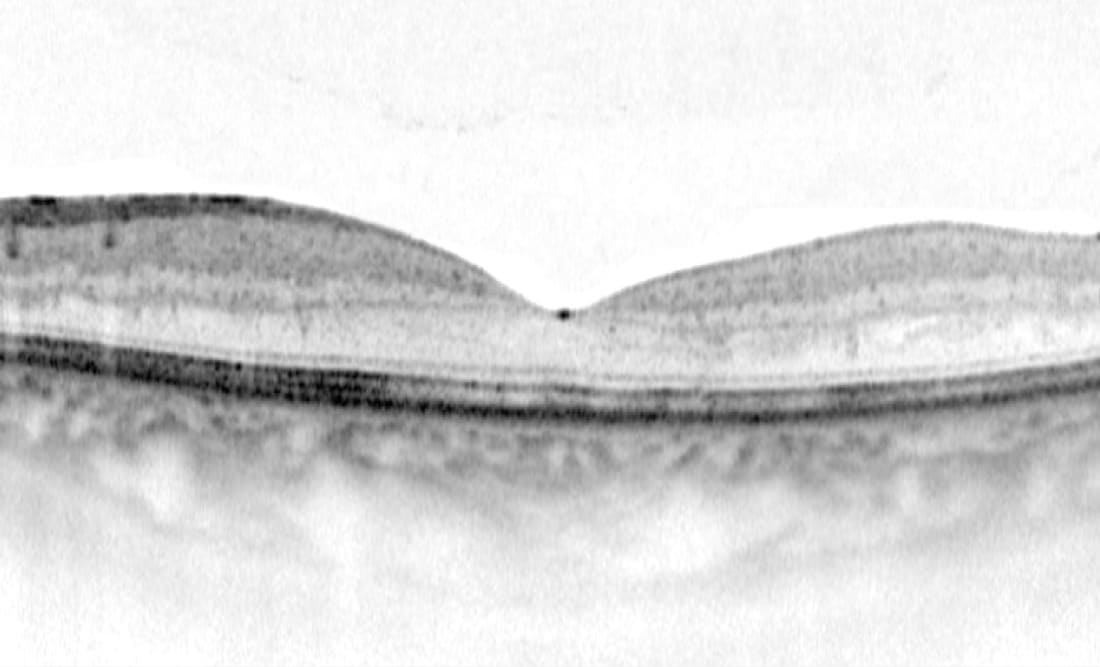 Schwarz-weiß OCT-Aufnahme (optische Kohärenztomografie) eines gesunden Auges, die die verschiedenen Schichten der Netzhaut in einem Querschnitt zeigt.